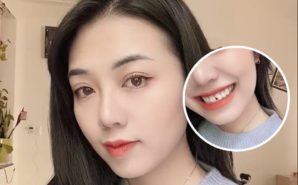 Cắn móng tay cũng bị mẻ mất nửa cái răng, gái xinh vinh hạnh nhận danh hiệu "Thánh nhọ đầu năm"
