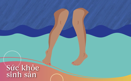 Nguyên nhân đổ mồ hôi vùng kín và những bí kíp cần nhớ để cải thiện tình trạng này