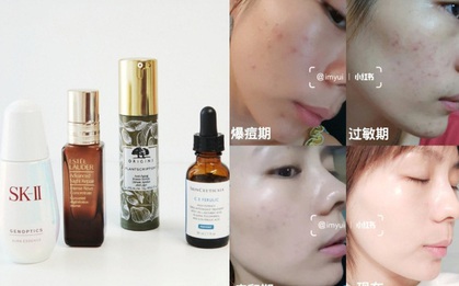 Da thiên dầu và nhiều thâm mụn, cô nàng này đánh cược với 4 sản phẩm thuộc loại "xịn sò" và rút ra vài kinh nghiệm vàng