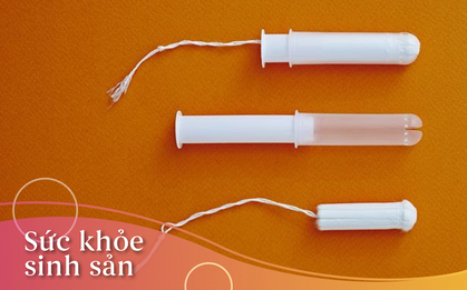 Băng vệ sinh bị kẹt ở... "chỗ ấy", phải làm sao đây?