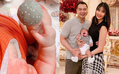 Lan Khuê xót xa kể chuyện con trai bị chàm do di truyền, mới 4 tháng tuổi đã phải chữa trị bằng mọi cách