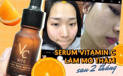 Từ chỗ thâm mụn tùm lum, làn da của tôi đã lột xác sáng mịn, căng bóng nhờ quy trình hợp lý, đặc biệt là loại serum Vitamin C bình dân của Thái Lan