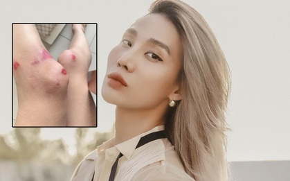 Xui như Mid Nguyễn (The Face): Cuối năm ngoái bị tài xế công nghệ hành hung, sang năm mới bị té xe, điện thoại vỡ nát