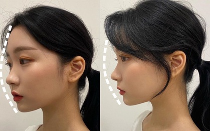 Buộc tóc đuôi ngựa thôi mà vẫn giấu được trán dô, hói, mặt béo tròn... chỉ nhờ "lợi dụng" vài lọn tóc mai
