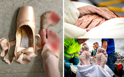 Ám ảnh nghề nghiệp kinh dị trên thân thể của vận động viên thể thao khiến ai cũng rùng mình sợ hãi