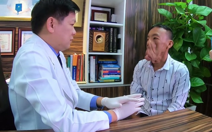 Chuyện người đàn ông mang "khuôn mặt quỷ" đến Sài Gòn tìm lại khuôn mặt người