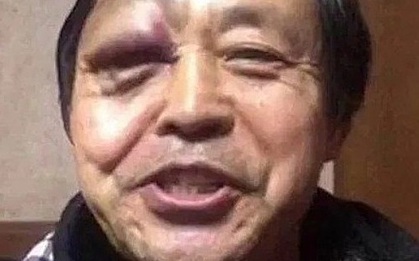 Trả hàng đống tiền học phí, võ sinh Anh thất vọng với võ công thật của sư phụ người Trung Quốc