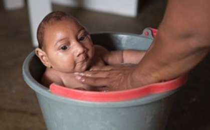 Việt Nam ghi nhận ca bệnh Zika đầu tiên trong năm 2020, loại virus có thể gây dị tật đầu nhỏ cho trẻ
