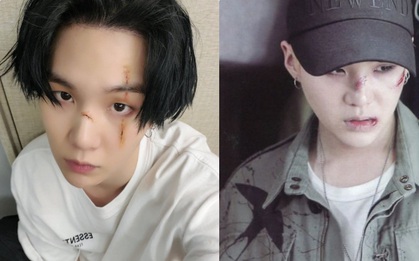 Bí mật giờ mới kể về vết sẹo trong "Daechwita" của SUGA (BTS): Từng có vết sẹo ngay giữa mũi nhưng sao lại trùng hợp với MV từ năm 2016 thế này?