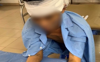 8 giờ, 30 y bác sỹ vừa phẫu thuật vết thương sọ não, vừa nối đồng thời 2 bàn tay đứt rời cho nam bệnh nhân ở Thái Nguyên