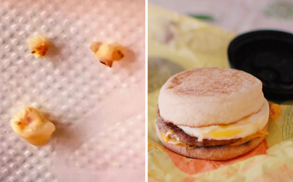 Cắn phải… răng người trong món bánh của McDonald’s, vị khách Nhật tá hoả nhưng phản ứng của cửa hàng khiến ai cũng lắc đầu