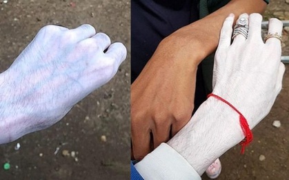 Loại kem trắng da mới khiến dân mạng Thái Lan rợn người vì độ tẩy trắng còn đáng sợ hơn cả bột giặt