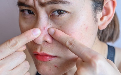 Điều gì khiến lỗ chân lông cứ ngày một "to ngoác": Chị em xem thử mình đang gặp phải vấn đề gì?