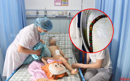 Cậu bé 3 tuổi bị thủng 8 lỗ ở ruột vì nuốt 22 viên bi nam châm vào bụng