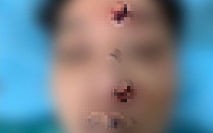 Nam sinh chết trong ký túc xá với 3 vết thương kỳ lạ, 27 phút cuối đời là một bí ẩn, nhà trường thúc giục gia đình ngừng điều tra