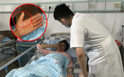 Chặt thịt lợn bằng tay trần, người phụ nữ sốt cao, bị viêm màng não do nhiễm liên cầu lợn