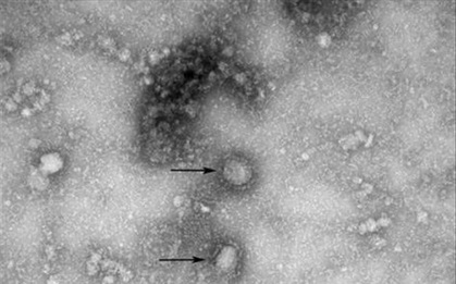 Xác nhận bệnh nhân Thái Lan đầu tiên bị nhiễm chủng virus corona mới