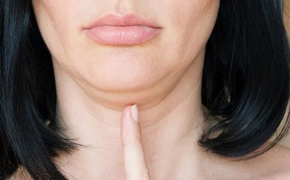 Bác sĩ "soái ca" xứ Đài chỉ ra cách diệt mỡ bụng, giảm nọng cằm đơn giản hết sức, chị em có thể thực hiện tại nhà ngon lành