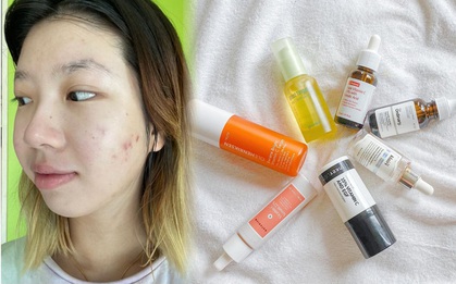 Nàng sinh viên review 5 serum vitamin C nổi tiếng: Không phải loại nào cũng "ok lah" như quảng cáo