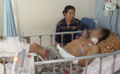 Kinh hoàng: 2 đối tượng lạ mặt tới nhà hỏi con trai ở đâu rồi bất ngờ chém đứt lìa chân người cha