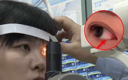 Thức khuya để làm thêm 1 tuần, người phụ nữ mắt có 'cặn như mỡ cừu', suýt bị mù