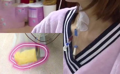 Cô gái 28 tuổi cấp cứu trong tình trạng máu vàng như "mỡ", viêm tụy cấp nặng vì thói quen ăn uống nhiều người trẻ vẫn làm
