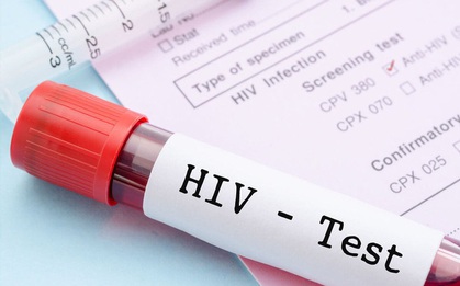 Vì sao độ tuổi được xét nghiệm HIV tự nguyện giảm xuống đủ 15 tuổi?