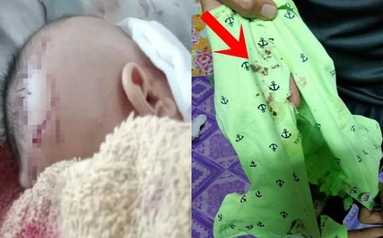 Đặt con 7 tuần tuổi một mình ở phòng khách rồi nghe thấy tiếng khóc, bà mẹ tức tốc chạy vào rồi chứng kiến cảnh tượng đẫm máu