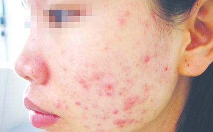 Sát Tết, lại khổ vì mỹ phẩm giả
