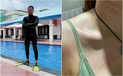 Nhà thiết kế thời trang Ruby Trần tố bị bạn trai cũ HLV bơi bạo hành dã man đến điếc 1 bên tai, nợ tiền không trả