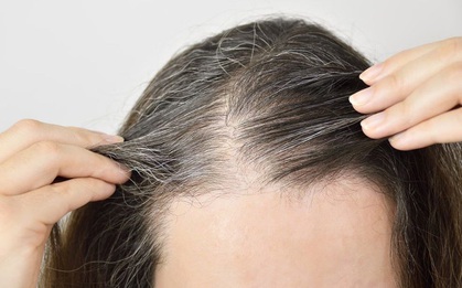 5 đặc điểm thường có ở nữ giới giúp họ nhận biết mình có nằm trong nhóm "sống thọ" hay không
