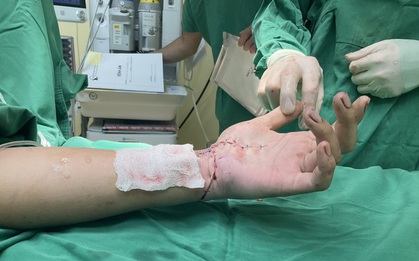 Nối thành công bàn tay gần đứt lìa cho nam thanh niên