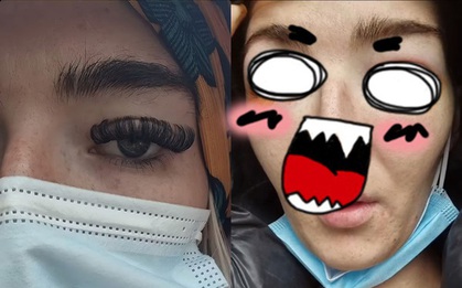 Đầu tư 1,4 triệu đi nối mi kiểu búp bê Nga cho xinh, chỉ 2 ngày sau cô gái nhận kết cục ê chề suýt mù cả 2 mắt