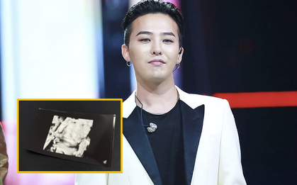 Sau 2 năm chờ đợi, G-Dragon đã chính thức lên chức nhờ tin vui “nổ trời” của gia đình!