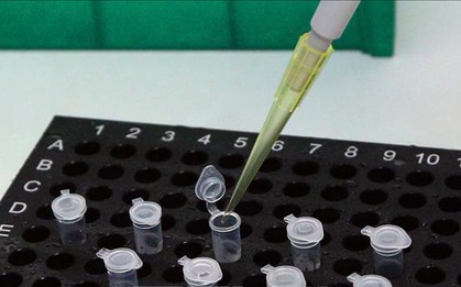 Các trường hợp F1 của bệnh nhân 2002 âm tính lần 1 với SARS-CoV-2