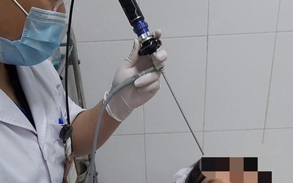 Đỉa vào sống ký sinh trong mũi người đàn ông sau khi uống nước suối