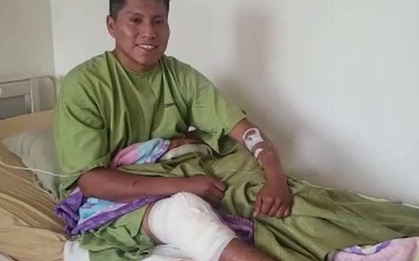 May mắn hay xui xẻo? Người đàn ông hai lần gặp tai nạn thảm khốc song vẫn sống sót thần kỳ