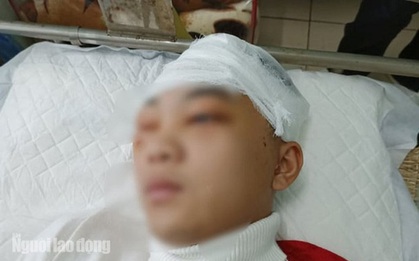 Khởi tố, bắt giam nam sinh lớp 11 đánh bạn học vỡ sọ não