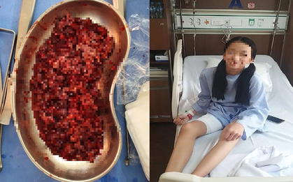 Tưởng con đau hông vì đang tuổi ăn tuổi lớn, hóa ra 'thủ phạm' là khối u khổng lồ như quả bom nổ chậm