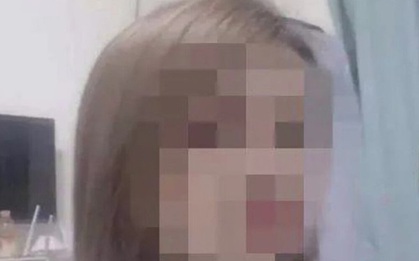 Bệnh nhân mặt trắng bệch, co giật rồi chết não khi cấy ghép mỡ để làm đẹp