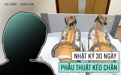 Cô gái Hà Nội giấu bố mẹ đi kéo chân: Không mua quần áo suốt nhiều năm để tiết kiệm, leo lên bàn mổ với ước mơ cao thêm 7cm