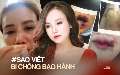 Trước “cô Xuyến” Hoàng Yến, loạt sao Việt từng bị chồng bạo hành dã man: Dương Yến Ngọc chịu đánh 2-3 lần/ tuần, 1 Hoa hậu còn muốn tự tử