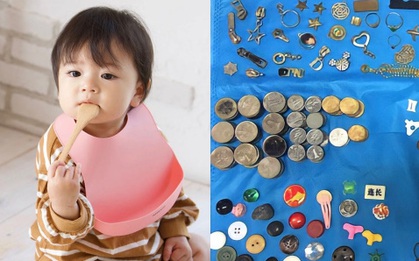 3.000 dị vật được bác sĩ gắp ra từ trong bụng của trẻ nhỏ, rất nhiều thứ bạn chẳng bao giờ có thể ngờ tới