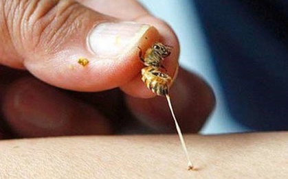 Thương tâm: Bé 2 tuổi tử vong vì bị ong vò vẽ nhà hàng xóm nuôi đốt khoảng 40 vết