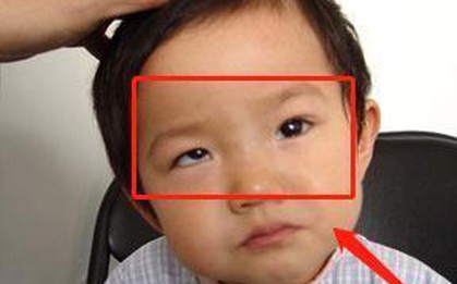 Bé trai 5 tuổi mắt thâm đen, con ngươi 1 bên gần như biến mất, tất cả chỉ vì thói quen độc hại này