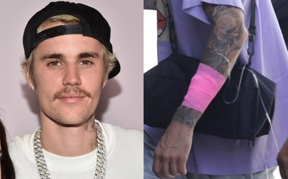 Justin Bieber hé lộ lý do xuống sắc không phanh gần đây: Mắc bệnh hiếm gặp ảnh hưởng đến não!