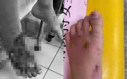 Thuê bảo mẫu chăm sóc con trai, người mẹ sốc nặng khi phát hiện cơ thể tàn tạ của đứa trẻ