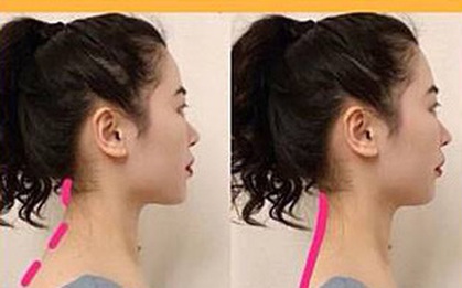 Muốn có lưng thẳng, dáng thon để mặc gì cũng đẹp: áp dụng ngay 3 động tác để nhận lại sự thay đổi
