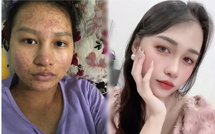 Cô vợ nhan sắc tàn tạ được chồng "đắp tiền vào người", cứ hờn dỗi là được cho trăm triệu