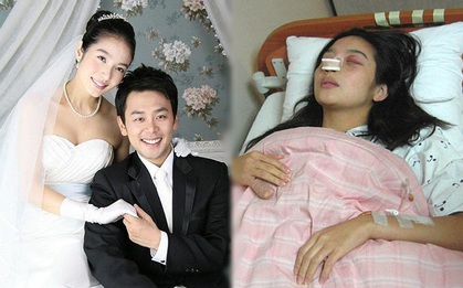 Cô vợ khổ nhất Kbiz: Chồng đánh sảy thai, gãy mũi rồi ly dị sau 12 ngày, chật vật làm lại cuộc đời giờ thăng hạng nữ chính